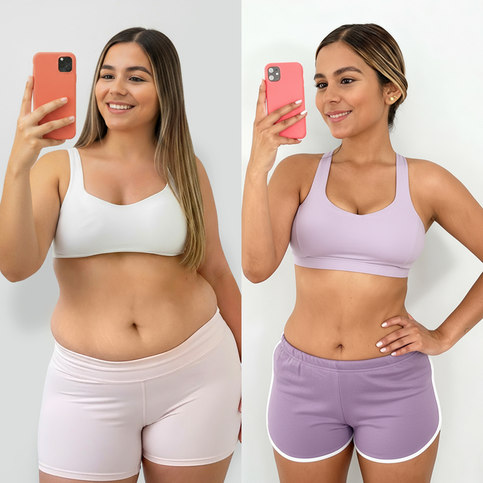 Resultado de antes y después de Camila