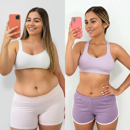 Resultado de antes y después de Camila
