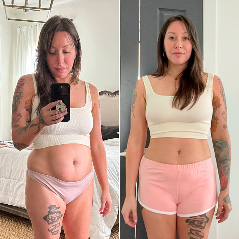 Transformación antes y después en abdomen femenino con Vibro Sculpt